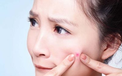 La rutina de belleza para decirle adiós a los granitos